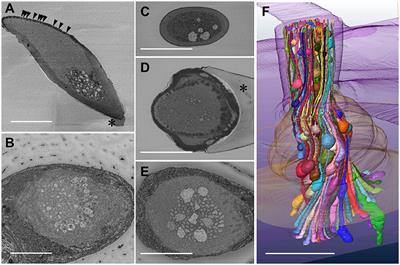 Putative Neural Network Within an Olfactory Sensory Unit for Nestmate and Non-nestmate Discrimination in the Japanese Carpenter Ant: The Ultra-structures and Mathematical Simulation